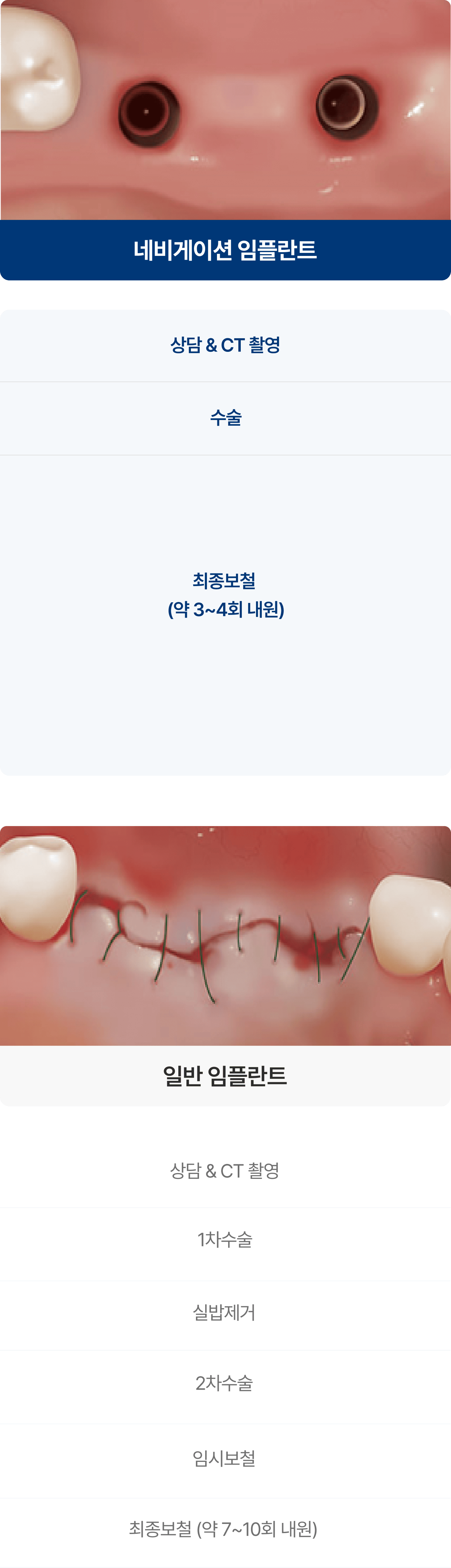 네비게이션 임플란트와 일반 임플란트의 차이