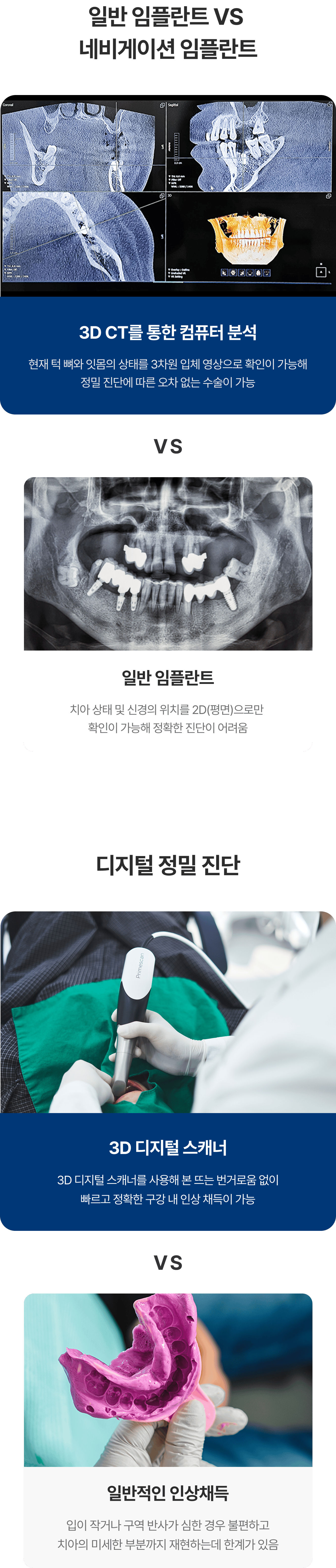 네비게이션 임플란트와 일반 임플란트의 차이와 디지털 정밀진단