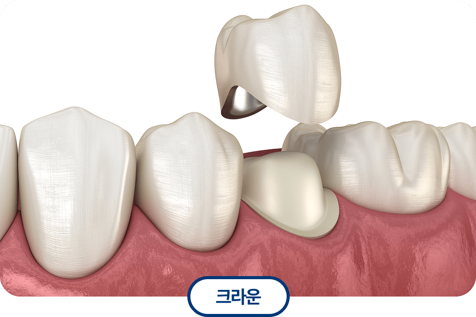크라운