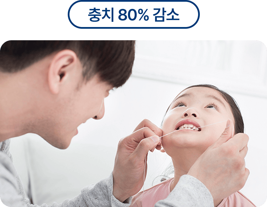 실란트