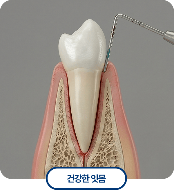 건강한 잇몸