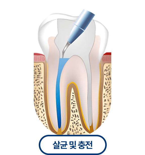 살균및충전