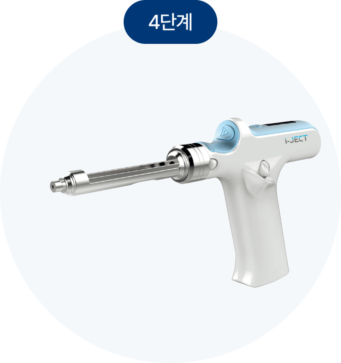 무통마취